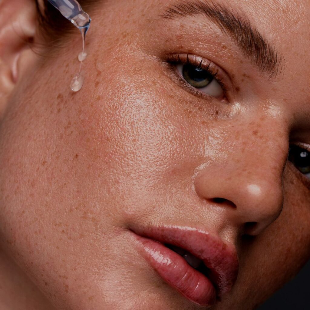 Acne Treatment